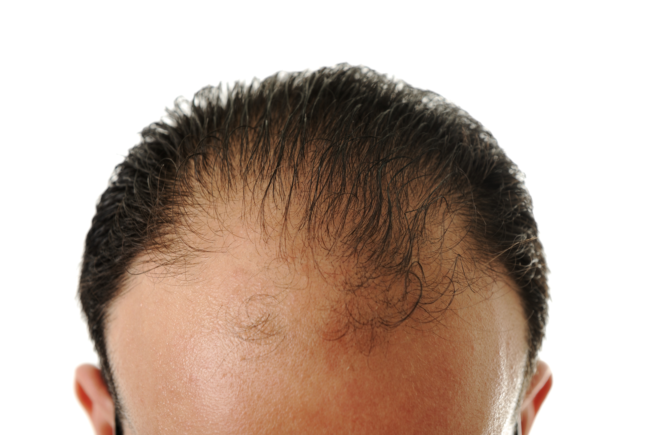 ホホバオイルで頭皮ケア 適度な保湿で乾燥や抜け毛 薄毛などを改善しよう 薄毛 抜け毛 頭皮の情報をご紹介 髪のせんせいmen Byスカルプdのアンファー