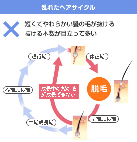 フィンペシアの初期脱毛 休止期脱毛 いつ始まっていつ終わるのか 薄毛 抜け毛 頭皮の情報をご紹介 髪のせんせいmen Byスカルプdのアンファー