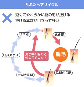 毛先の細い抜け毛が増えたら薄毛 ハゲ 進行のサイン 薄毛 抜け毛 頭皮の情報をご紹介 髪のせんせいmen Byスカルプdのアンファー