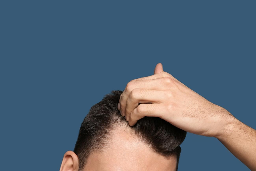 抜け毛がひどい場合の原因とは 抜け毛の状態をチェックして早めの対策を 薄毛 抜け毛 頭皮の情報をご紹介 髪のせんせいmen Byスカルプdのアンファー